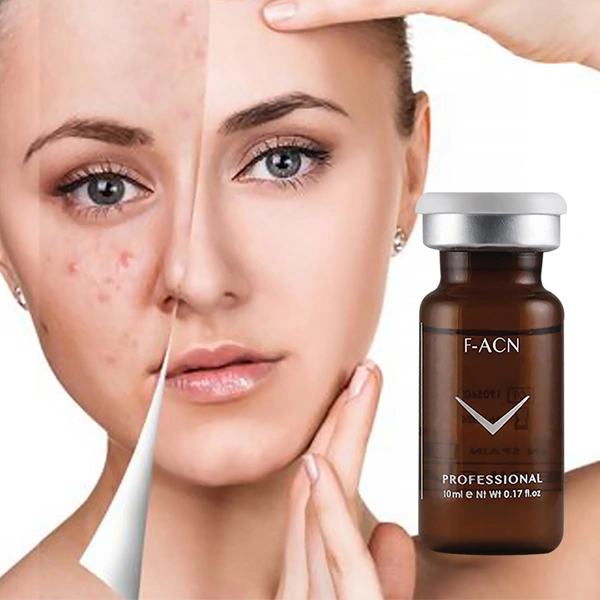 ترکیبات کلیدی در کوکتل F-ACN جوش و آکنه فیوژن