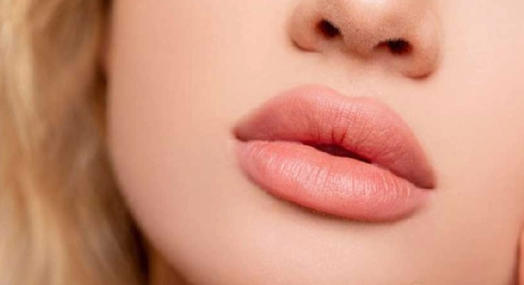 مقایسه فیلرهای کره‌ای و اروپایی.رستیلن