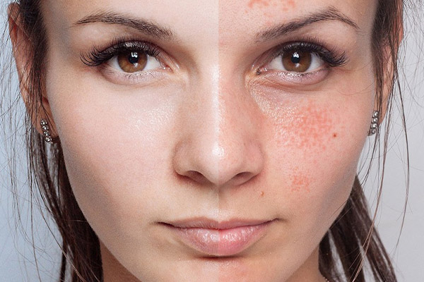 جالپرو یانگ آی تیک سبز